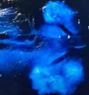a group of blue objects in the water