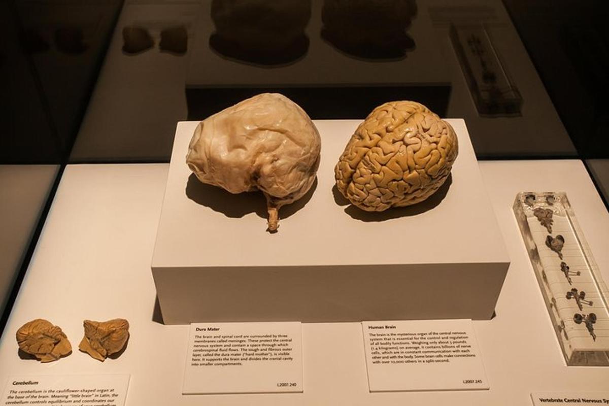 a display of two brain specimens on a table