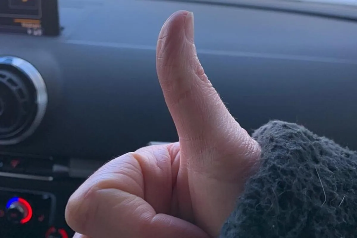 Ungewöhnliche Auto-Rallye rund um die Vogesenseen – Foto 19